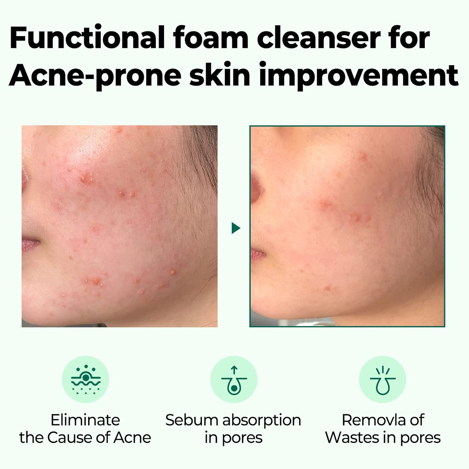 Some By Mi Aha Bha Pha 30Days Miracle Acne Clear Foam 100Ml